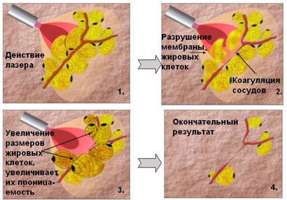Как отварить рыбу минтай для диеты