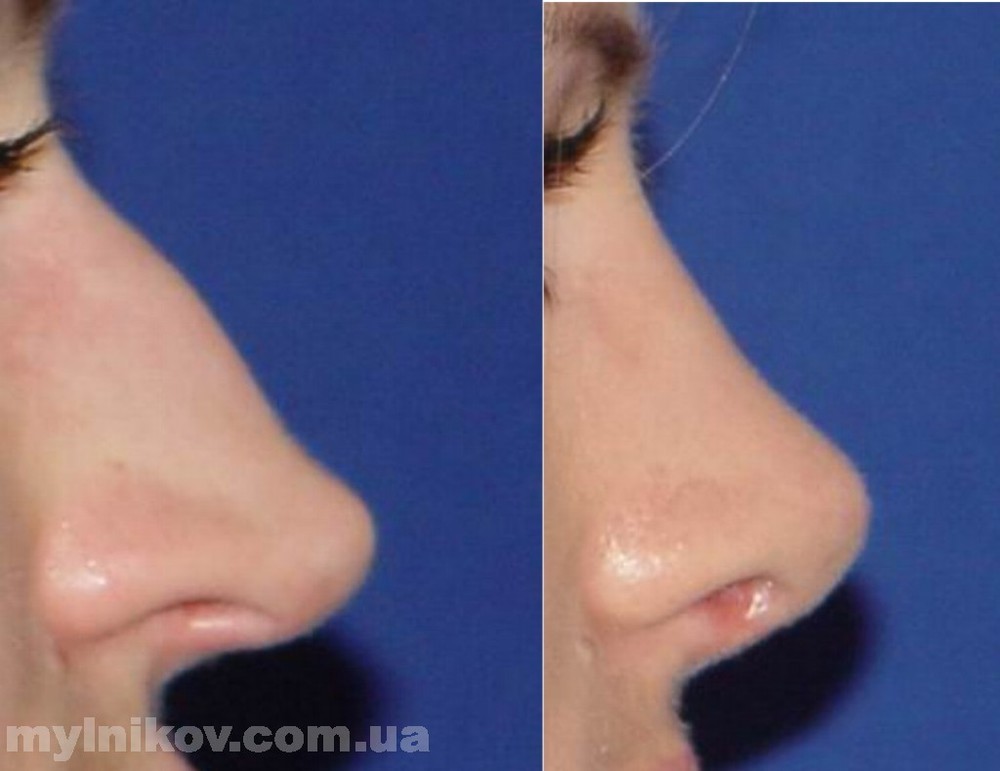 Девушки с маленькой грудью мнение