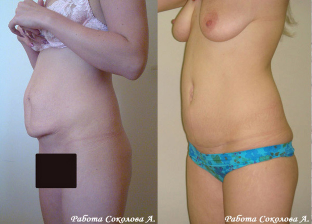 http://www.prof-medicina.ru/static/w1006/4d3d54a414287.jpg