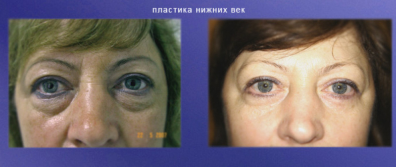Сочинение Бородинская битва - кульминация романа Л. Н. Толстого «Война.» Случай на свадьбе порно рассказы, секс истории. - SexyTales