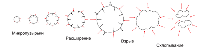 Техника выполнения ультазвуковой липосакции