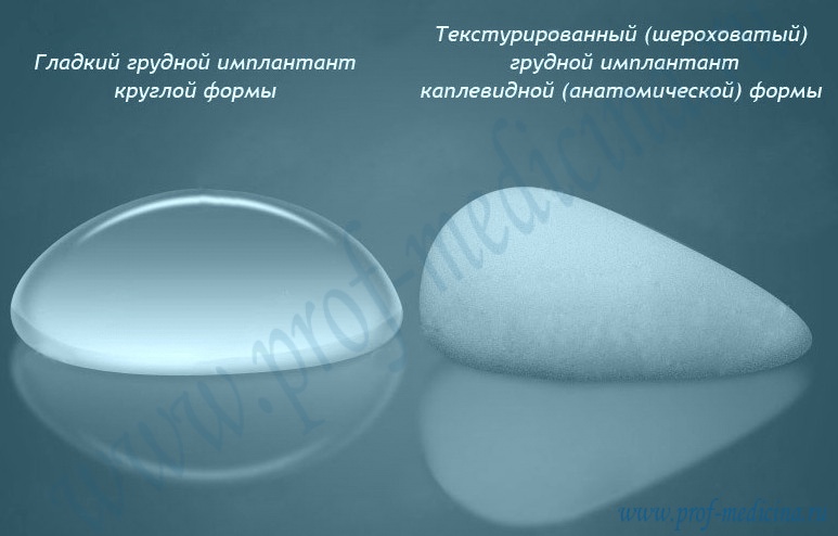Форма грудных имплантов
