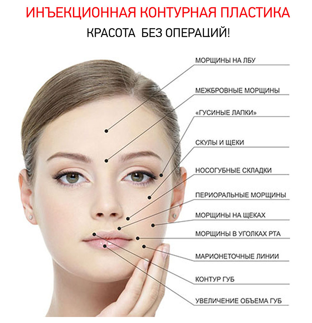 Схема введения ботокса на лице