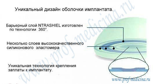 Оболочка грудных имплантантов Natrelle