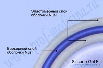 Оболочка имплантатов eurosilicone 