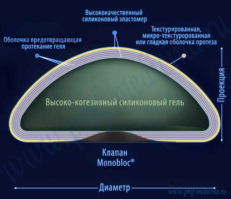 Гидрогелевые грудные имплантаты Monobloc Arion