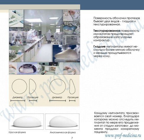 пверхность грудных имплантатов