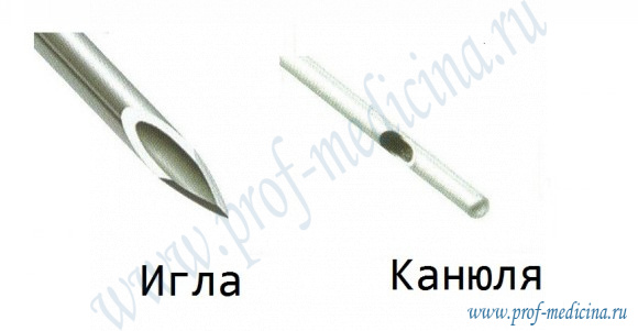 Канюли и зонды для липосакции: липосакция, пластические операции ...