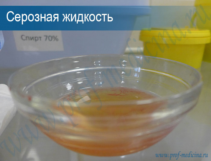 Серозная жидкость  