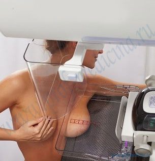Маммография после увеличения груди