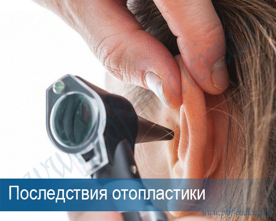 Колит уши после отопластики thumbnail