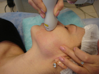 Аппарат для лазерного омоложения кожи лица palovia laser palomar отзывы