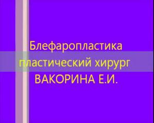 Пластика вокруг глаз видео