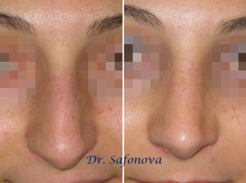 https://www.prof-medicina.ru/static/w800/515168d0b13ca.jpg